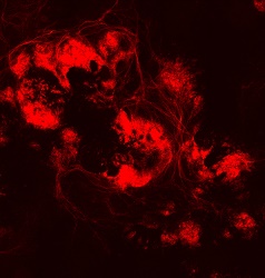 Retinal Nerve Cells ganglion cells