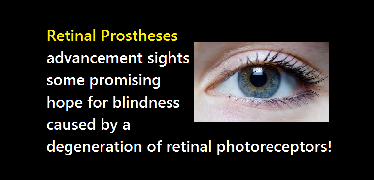 Retinal Prostheses - Retinitis Pigmentosa